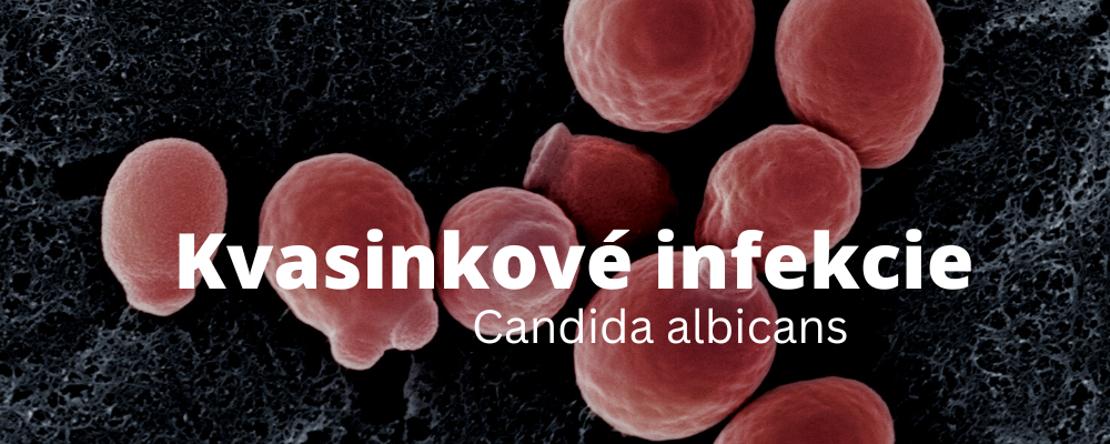 Candida a jej vplyv na zdravie