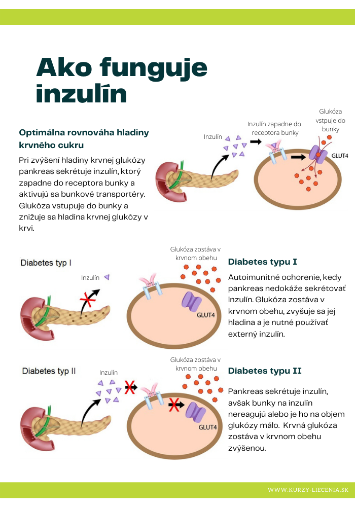 Grafické znázornenie fungovania inzulínu pri regulácii hladiny krvného cukru, vrátane rozdielov medzi diabetom typu I a typu II.